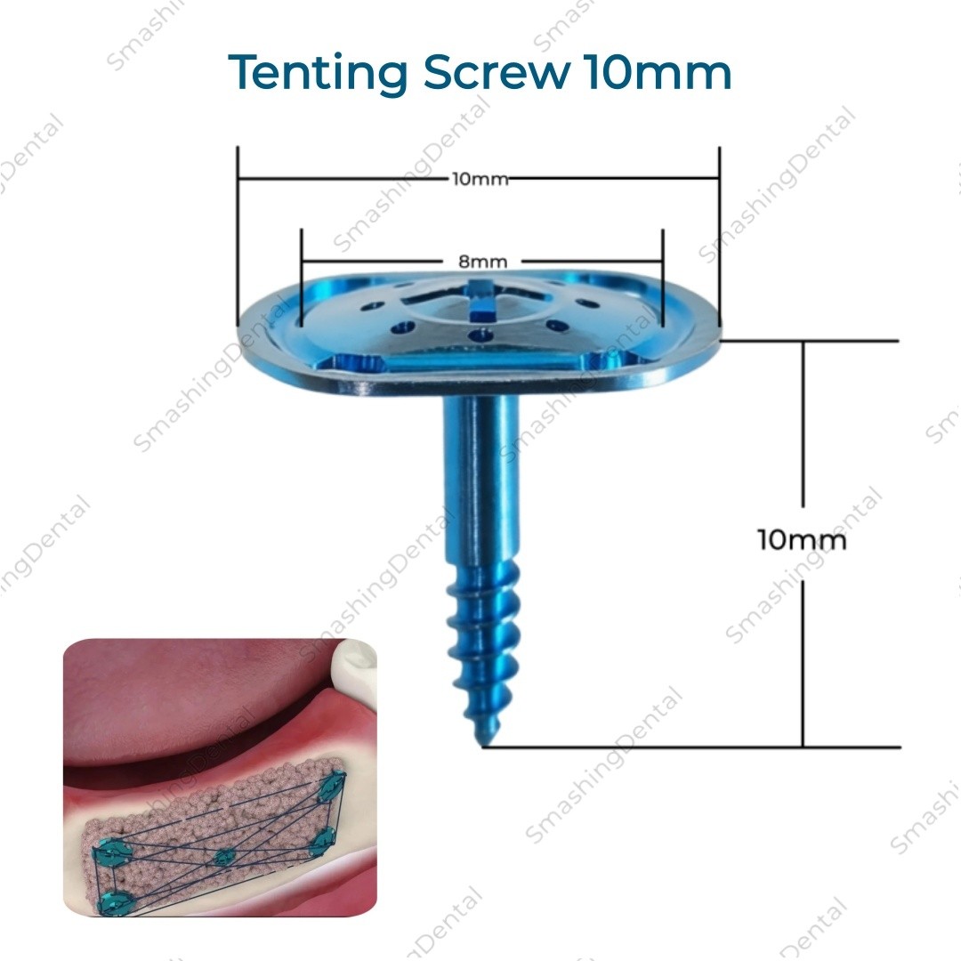 USA Dental GBR Tent Screw Wide Tenting Screw Driver Guide Regeneration Membrane