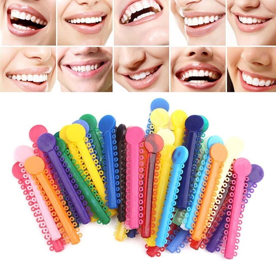 1040pcs Dental Orthodontic Ligature Ties Braces Elastic Rubber Bands ORA