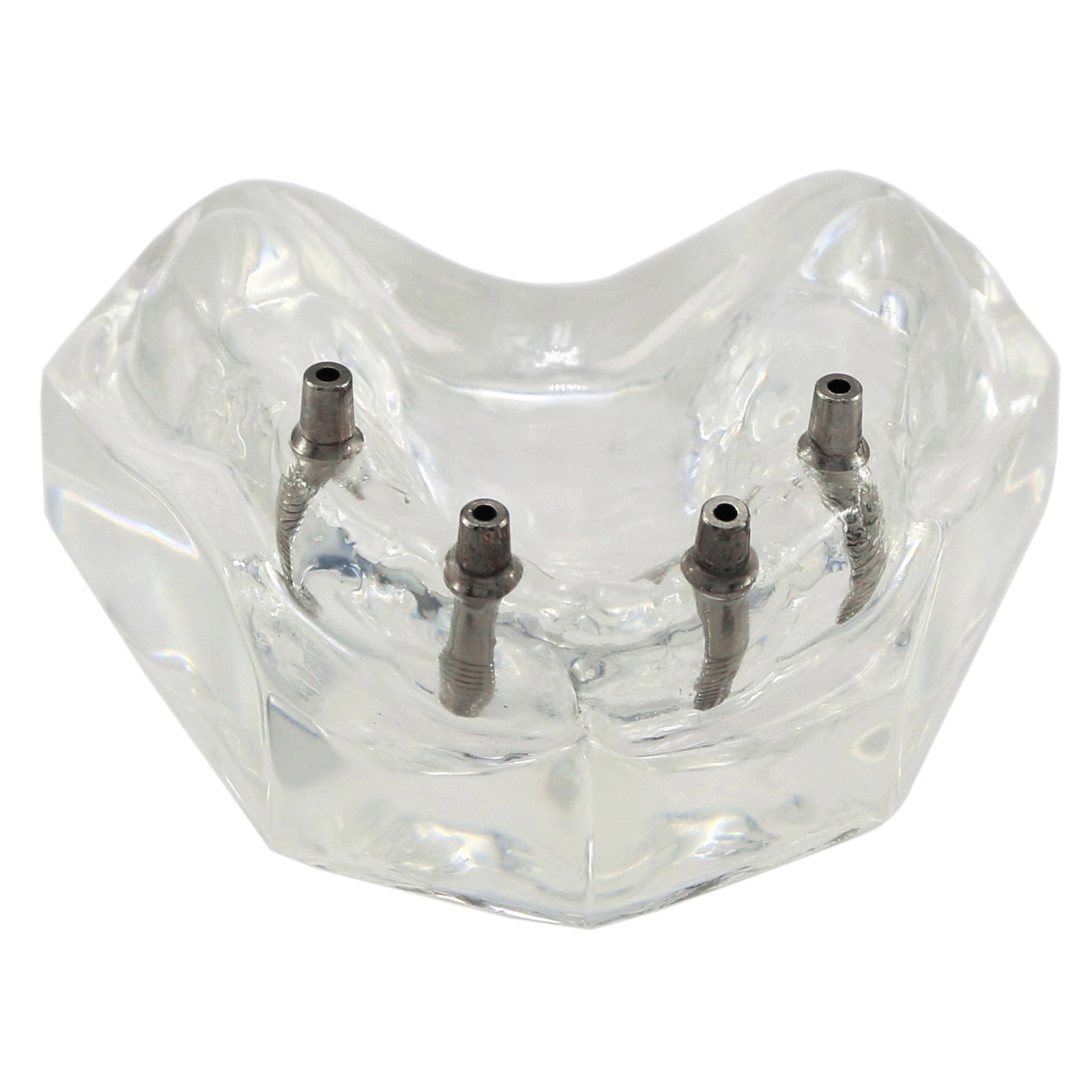 Dental Teeth Model 2 4 Implant Overdenture Typodont Restoration Demo Upper Lower