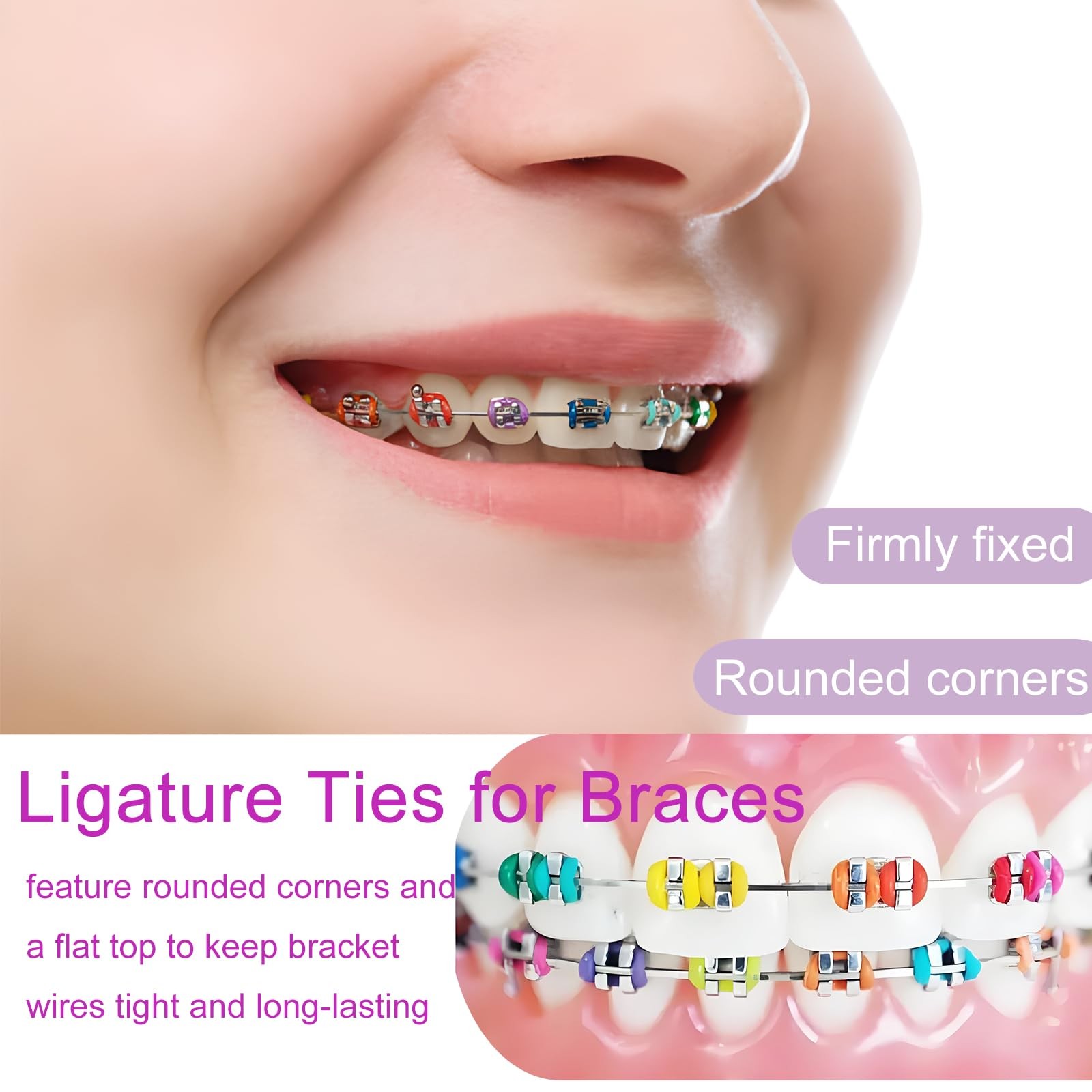 SNAWOP Orthodontic Ligature Ties 1040PCS Multi Color with Gun