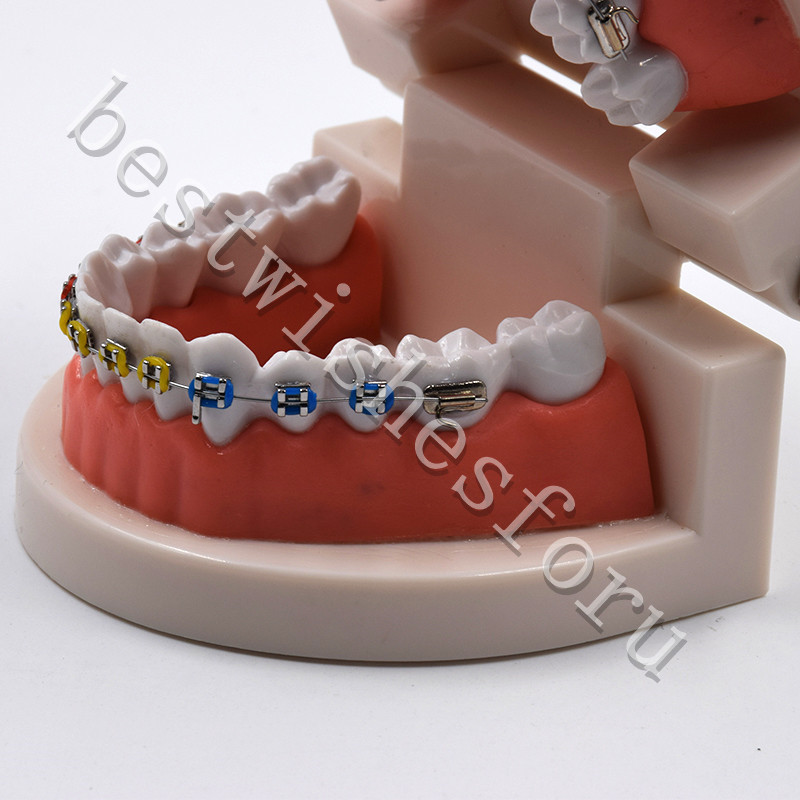 Dental Orthodontic Standard Teeth With Metal Brackets Ligature Ties Hoop Model