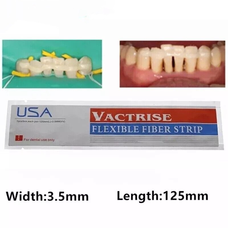 Dental Flexible Fiber Strip Glass Splint Loose Tooth Fixation Strips Light Cure