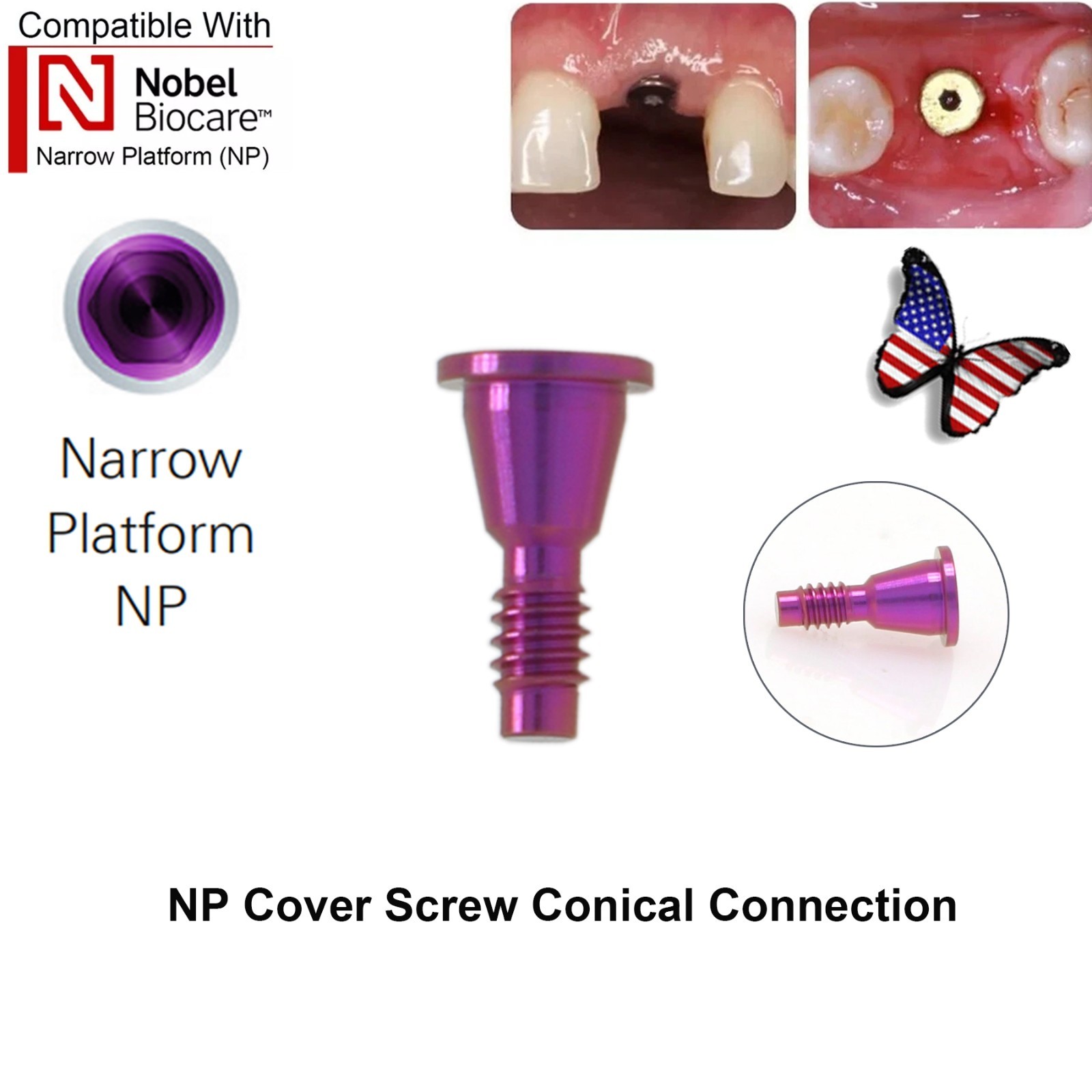 US Dental Cover Screw For Nobel Biocare NP RP Implant Conical Connection Healing