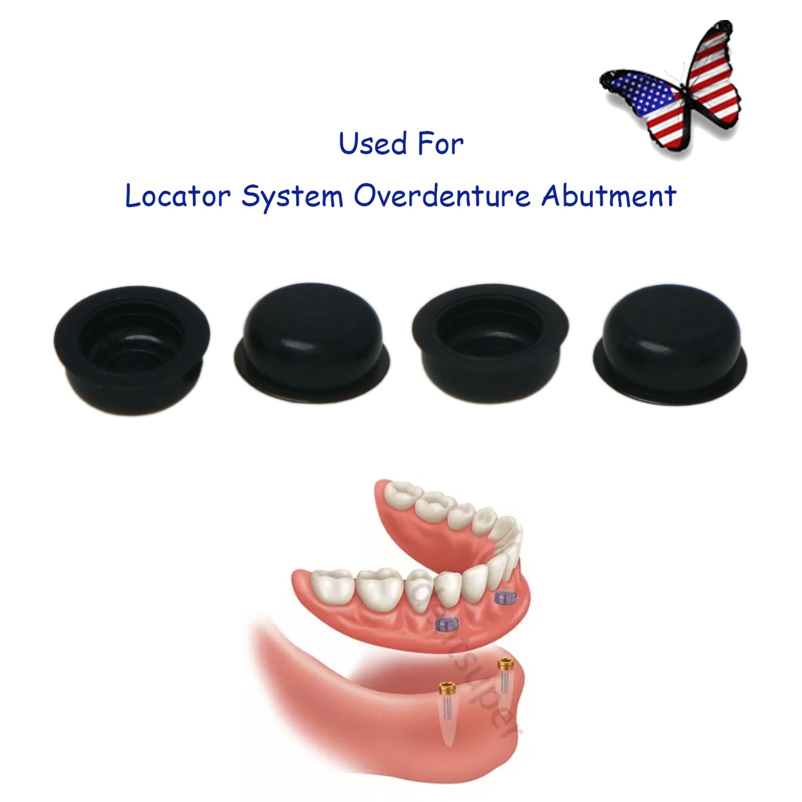 US Overdenture Retention Cap Kit 0.8/1.2/2.4lbs PEEK Material Locator Abutment