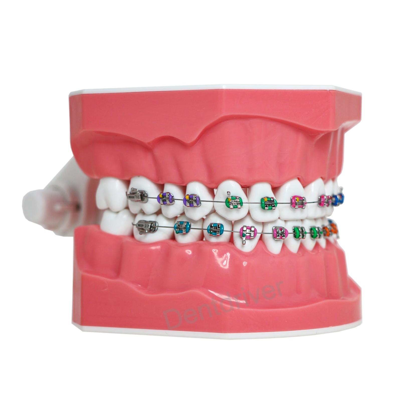 US Orthodontic Typodont 1:1 Teeth Model M7010-2 Fixed Brackets Braces Teaching