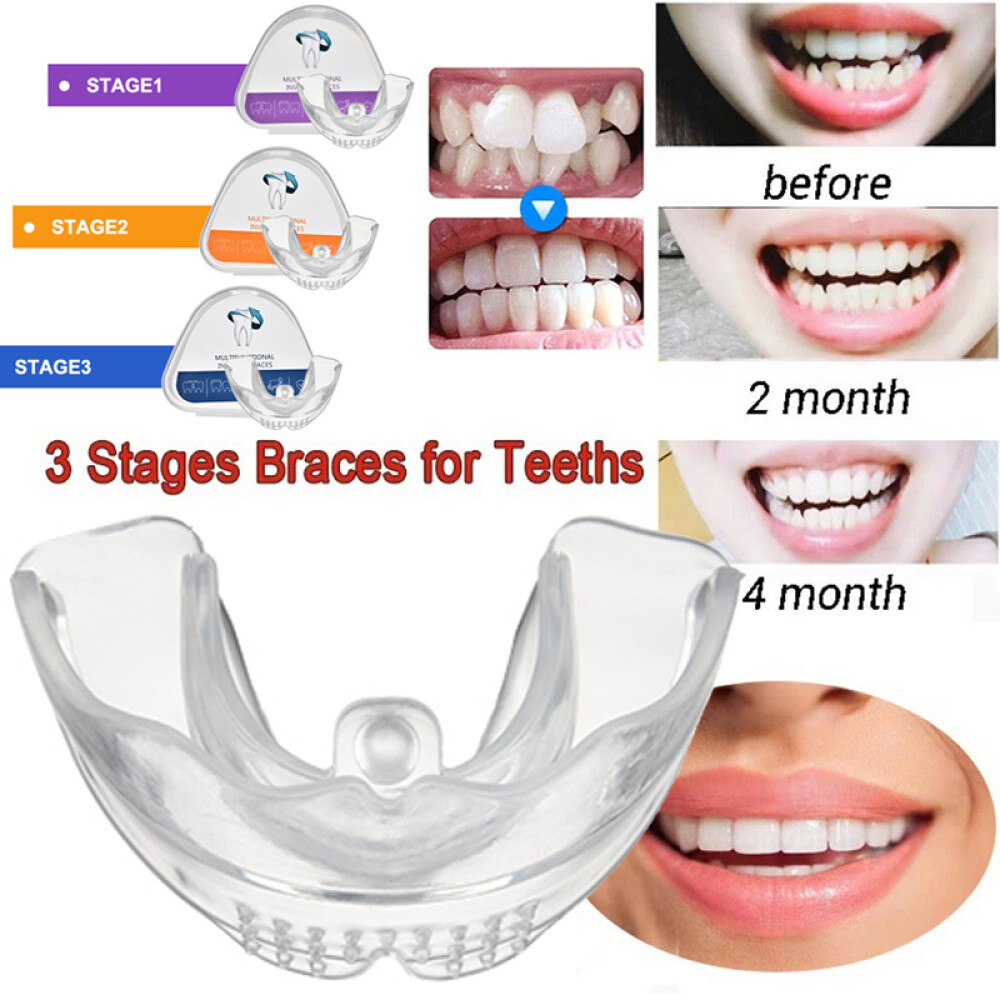 3-Stage Adult Teeth Aligners Orthodontic Braces Trainer for Dental Alignment Hot