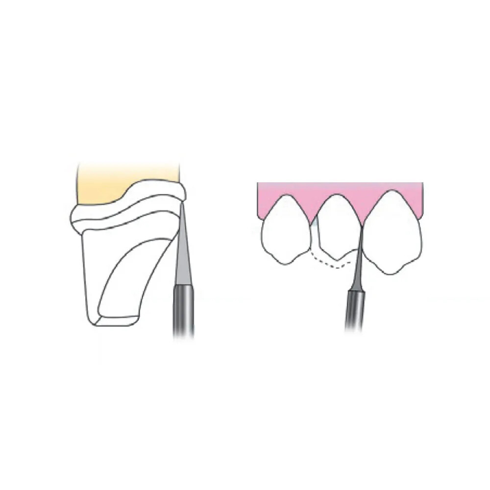 Frank Dental Tapered Cone Diamond Bur FG -TC (Made in India) diamond bur