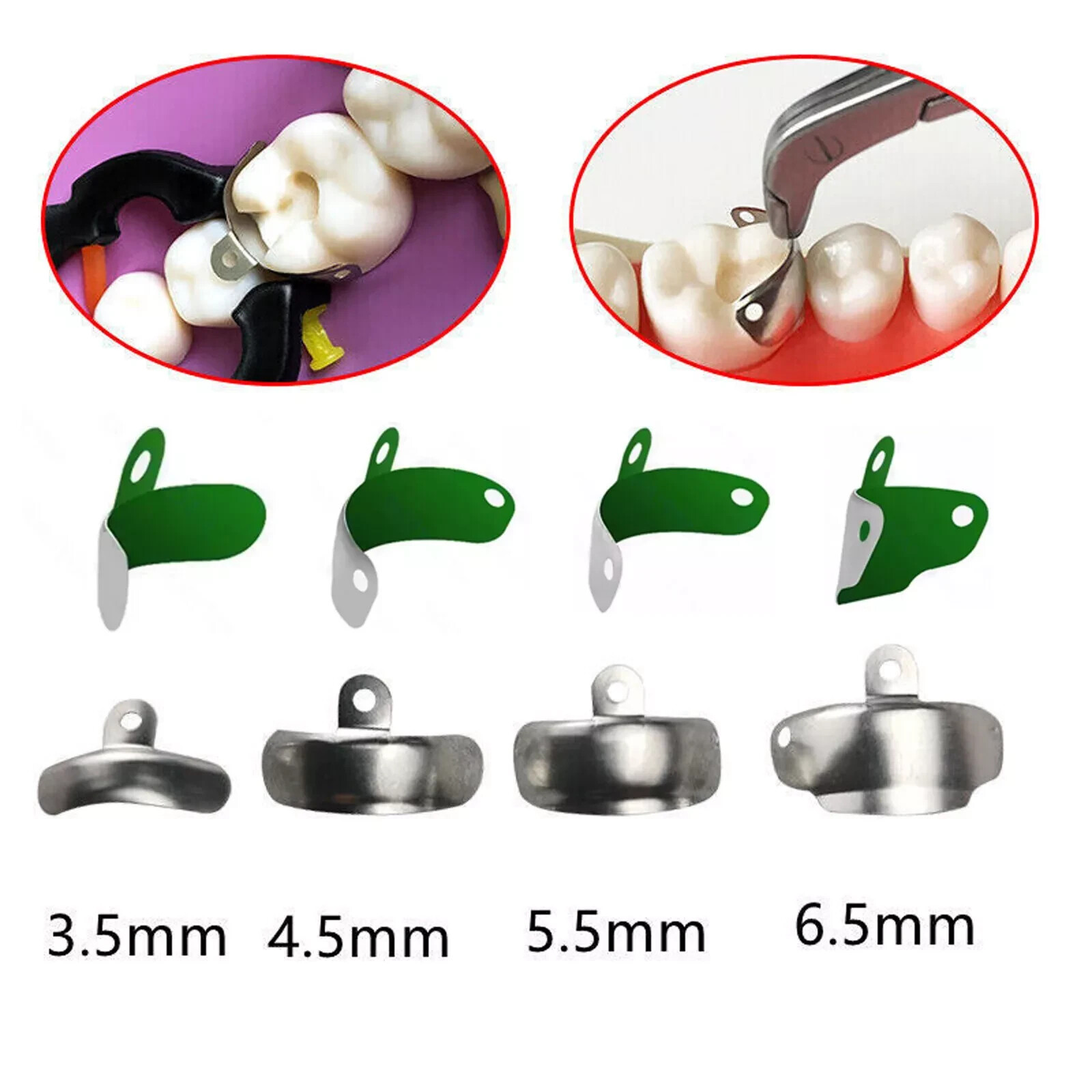50 Pcs/Box Dental Matrix Bands M4 Sectional Contoured Matrices Palodent V3 Style