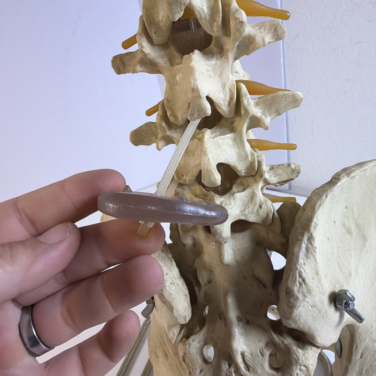 Vintage ORTHOFLEX Human Pelvis Vertebrae Skull Base Spinal Nerve Cord Spine