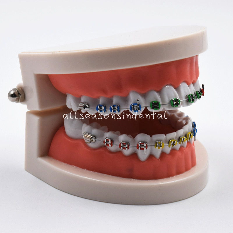 Dental Orthodontic Standard Teeth Model With Brackets Buccal Tube Ligature Ties