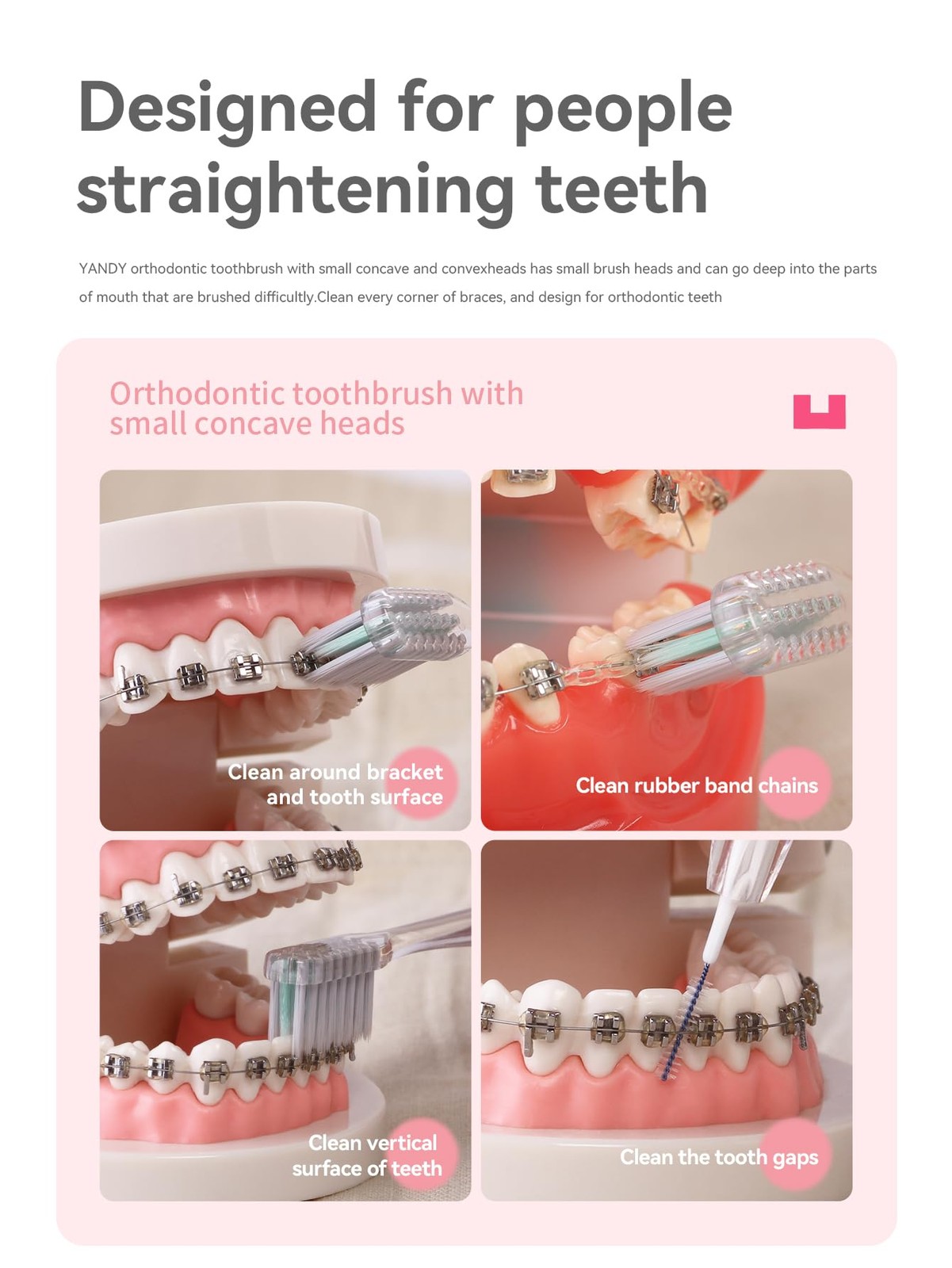 YANDY Concave Orthodontic Toothbrush for Braces Brackets, 1 Count (Pack of 1)