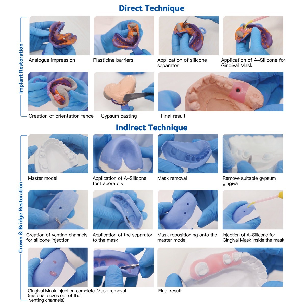 AZDENT Dental Lab A-Silicone Duplication Silicone Material for Gingival Mask