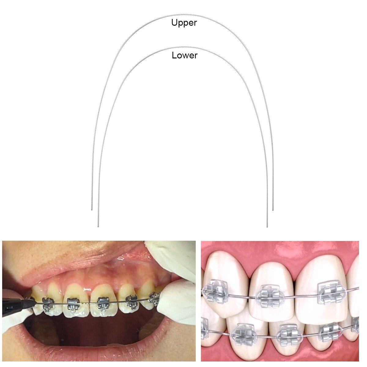 AZDENT Dental Orthodontic Super Elastic Niti Arch Wires Rectangular Ovoid/Nature