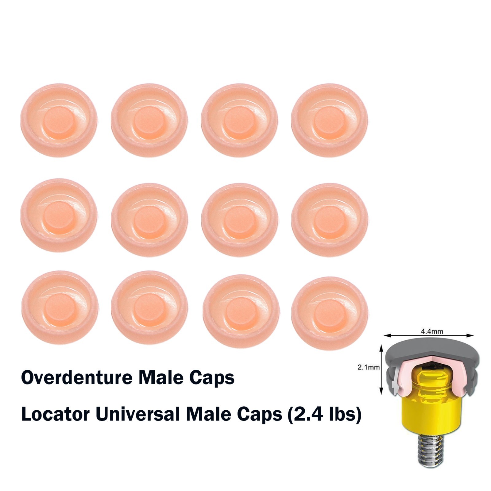 US ZEST Locator Replacement Retention Male Caps Inserts For Dental Overdenture