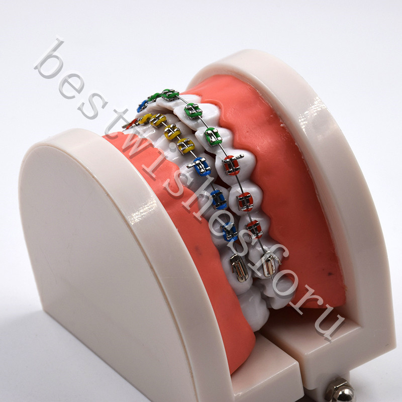 Dental Orthodontic Standard Teeth With Metal Brackets Ligature Ties Hoop Model