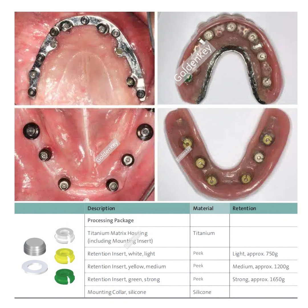 Dental Novaloc Retention Inserts Caps Peek Locator Mounting&Demounting Tool