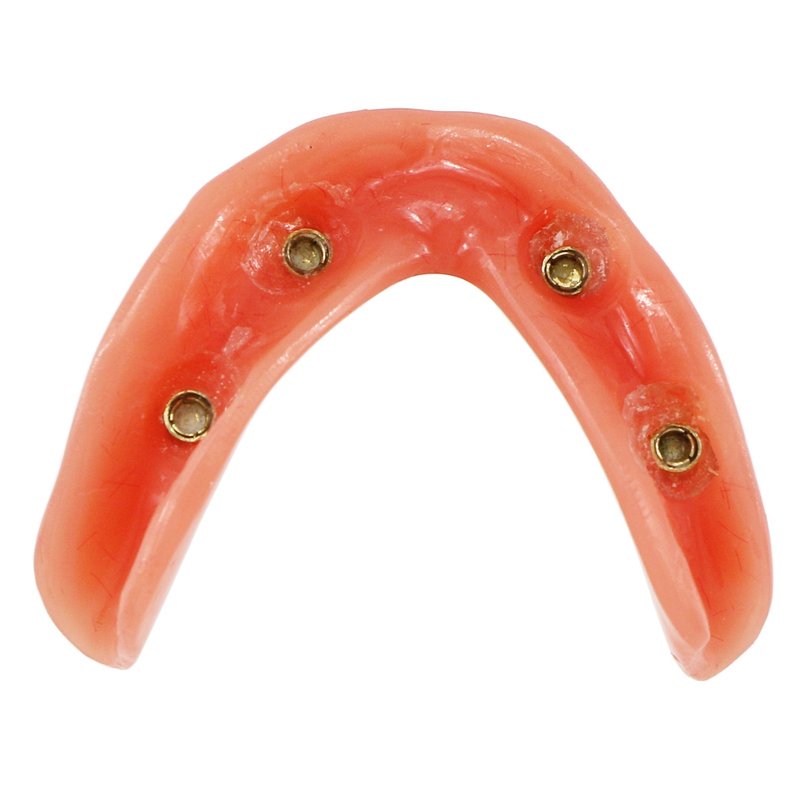 Dental Implant Overdenture Model Upper Lower Jaw Teeth Model with 2/4/6 Screws