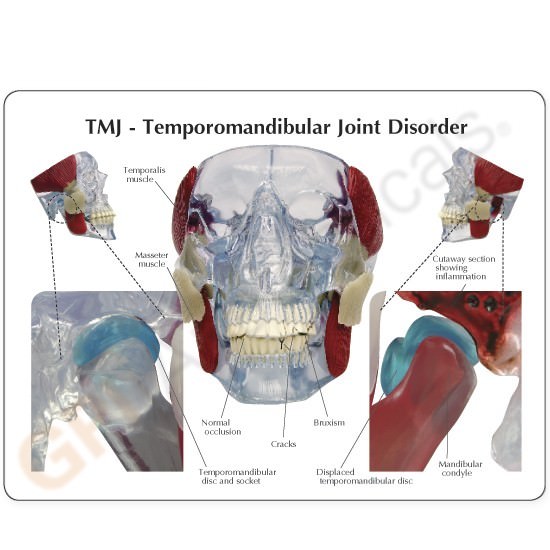 TMJ Temporomandibular Jaw GPI Model LFA #2880. Make Us an Offer! SEE VIDEO