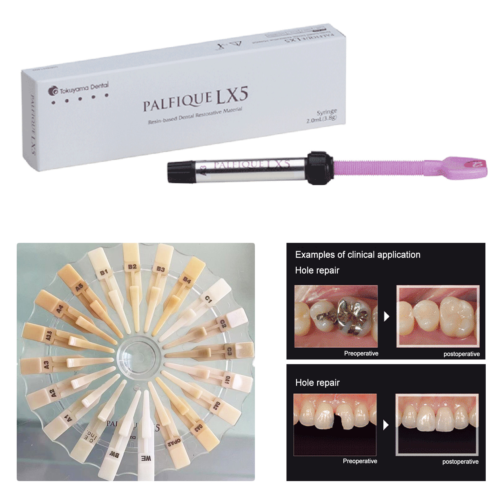 Palfique Tokuyama LX5 Resin Based Dental 3.8gm All SHADE Available
