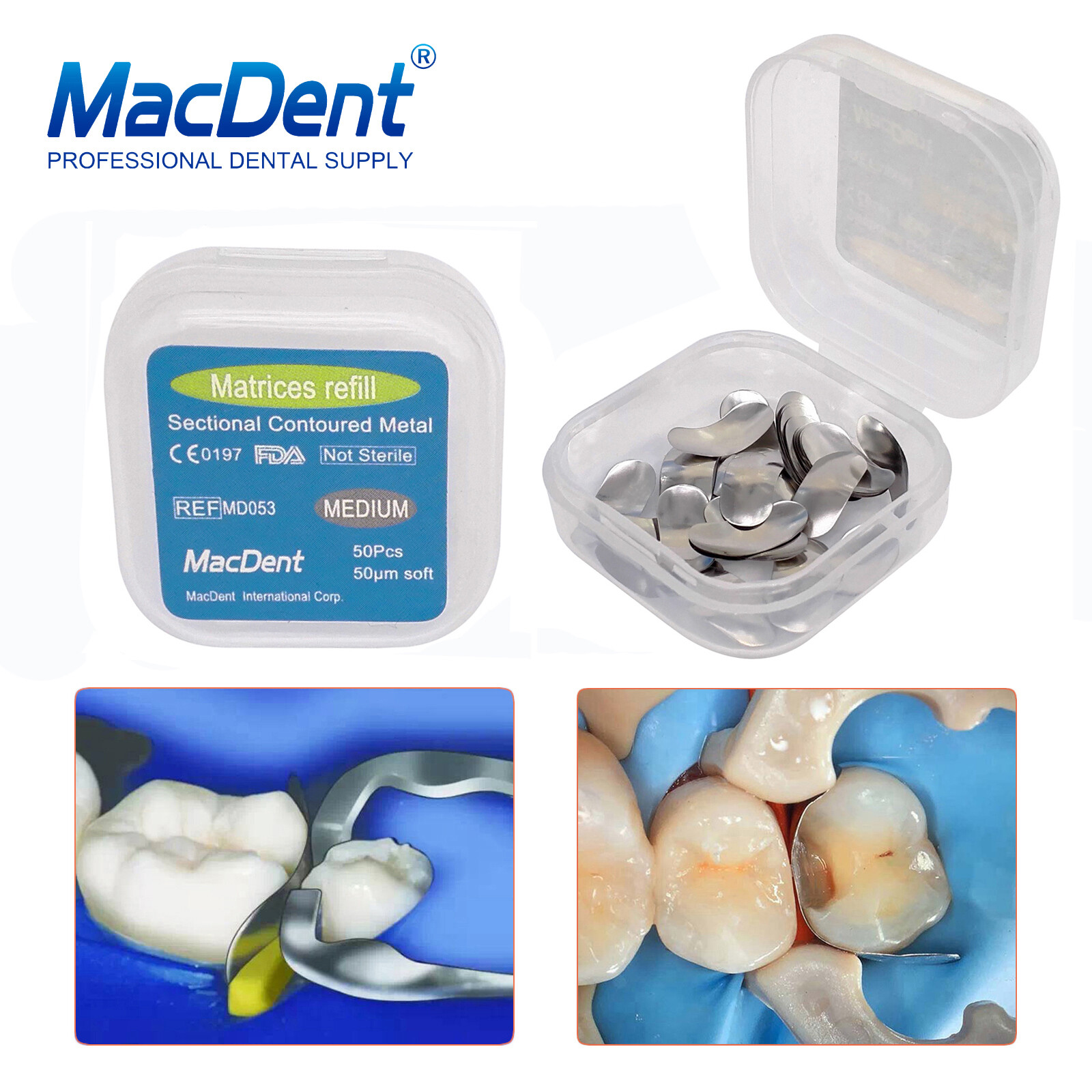 50Pcs/box MacDent Dental Sectional Contoured Matrices Matrix Bands Refill S/M/L