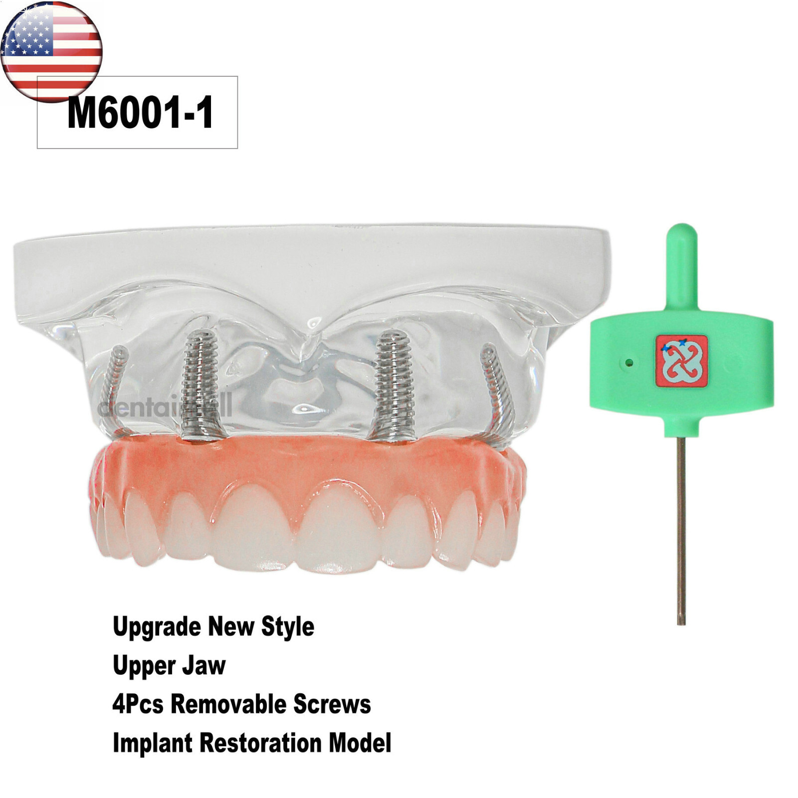 US Dental Overdenture All-on-4 Model Upper/Lower Jaw-Clear Implant With 4 Screws