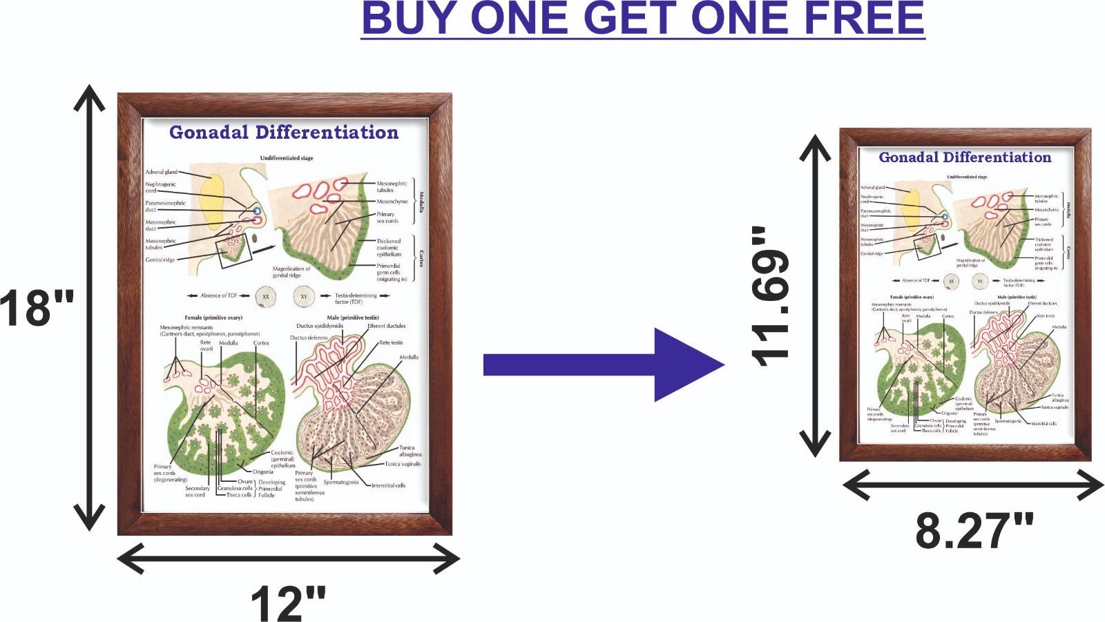 Gonadal Differentiation Chart 12×18 inches