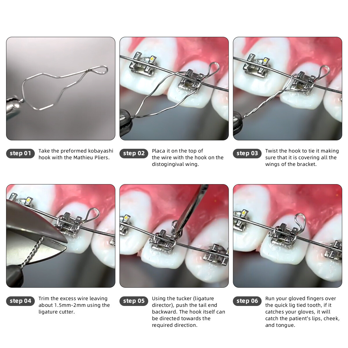 AZDENT Dental Orthodontic Wire Preformed Ligature Ties Short Twist Wires