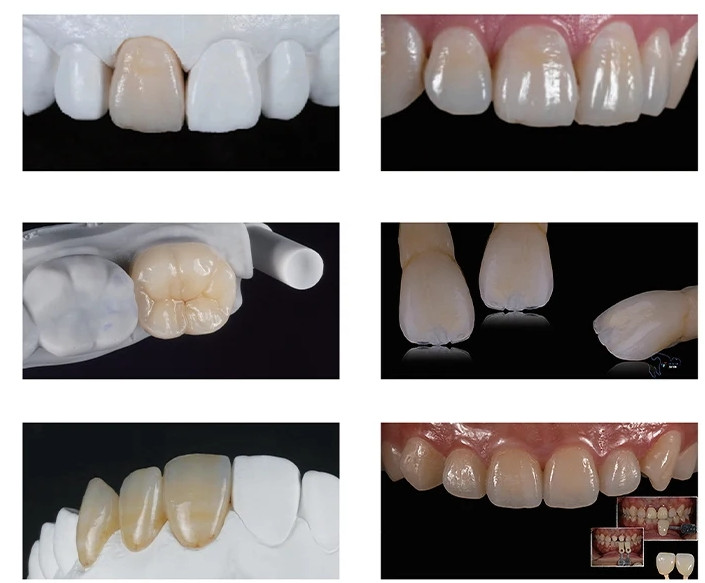 MT C14 Dental Emax CAD/CAM Glass Ceramic Blocks Lithium Disilicate CEREC Block