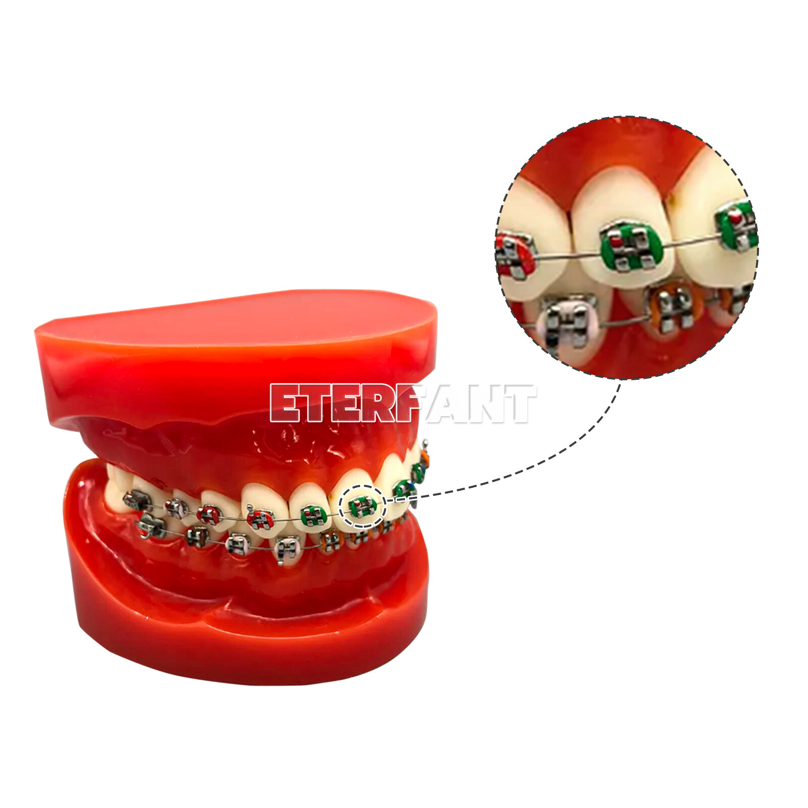 1040PCs ETERFANT Dental Ortho Ligature Ties Elastic Rubber Bands 18 Colors