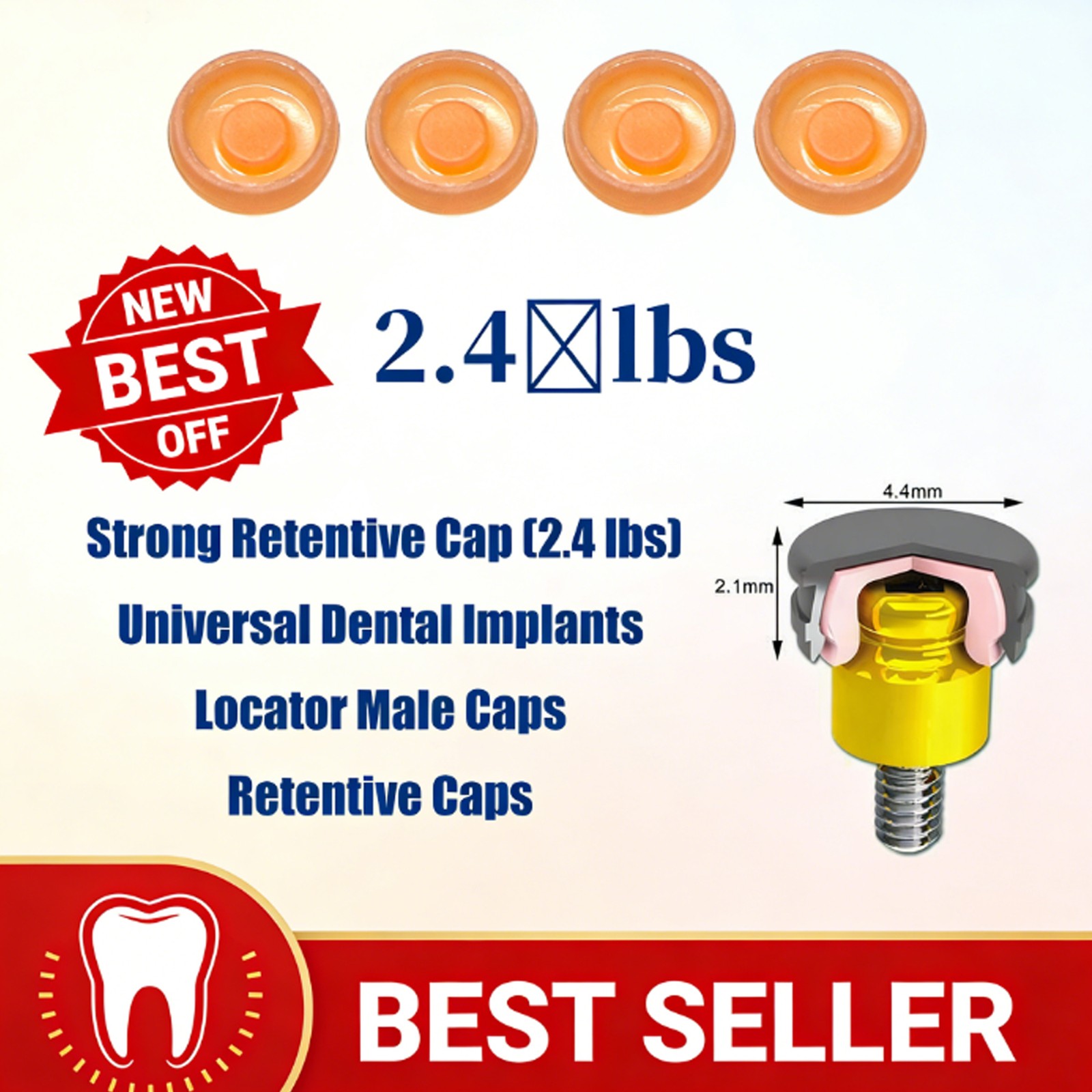 Dental Overdenture Zest Locator Abutment Legacy Anchor Hiossen Nobel Zimmer Cap