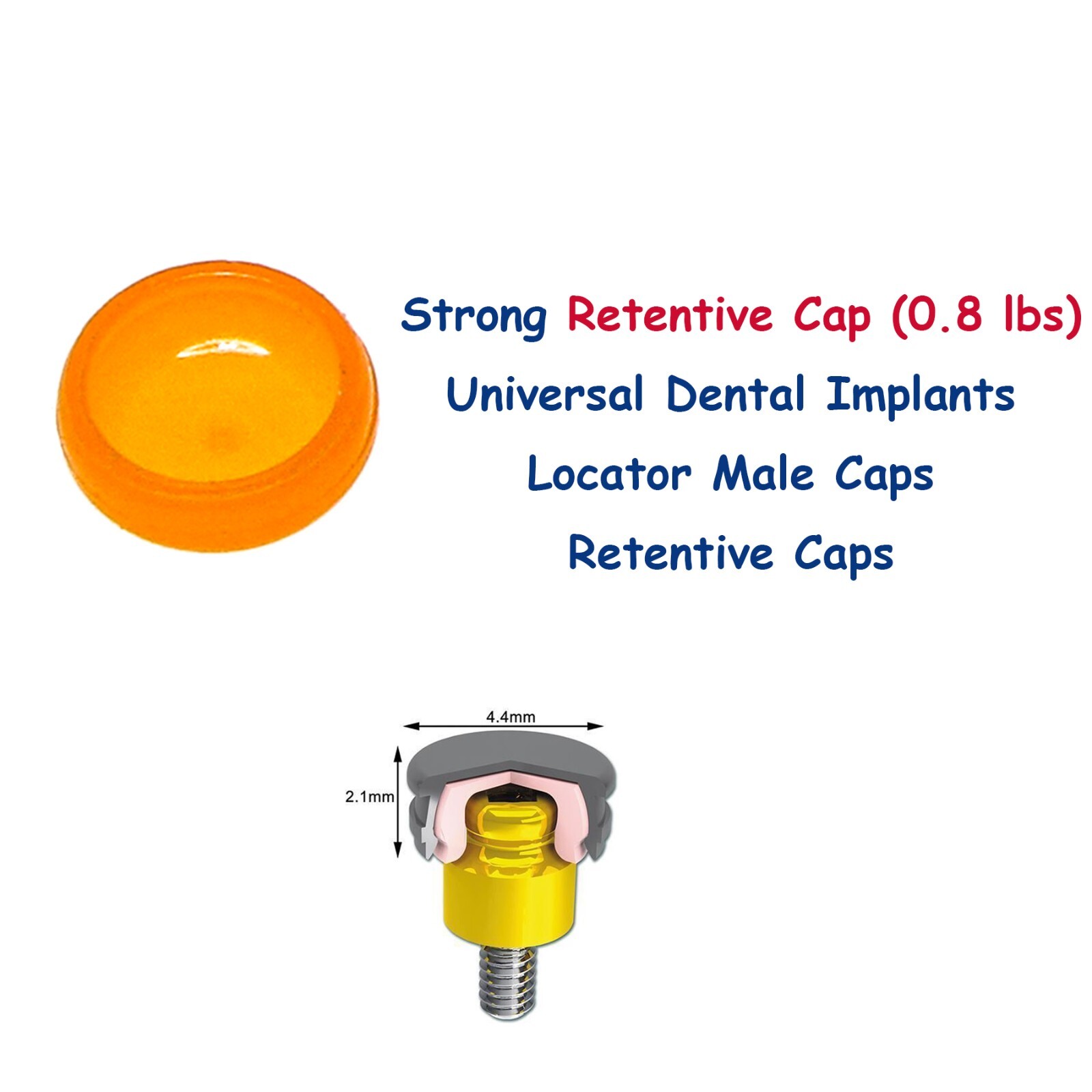 US Overdenture Retention Cap Kit 0.8/1.2/2.4lbs PEEK Material Locator Abutment