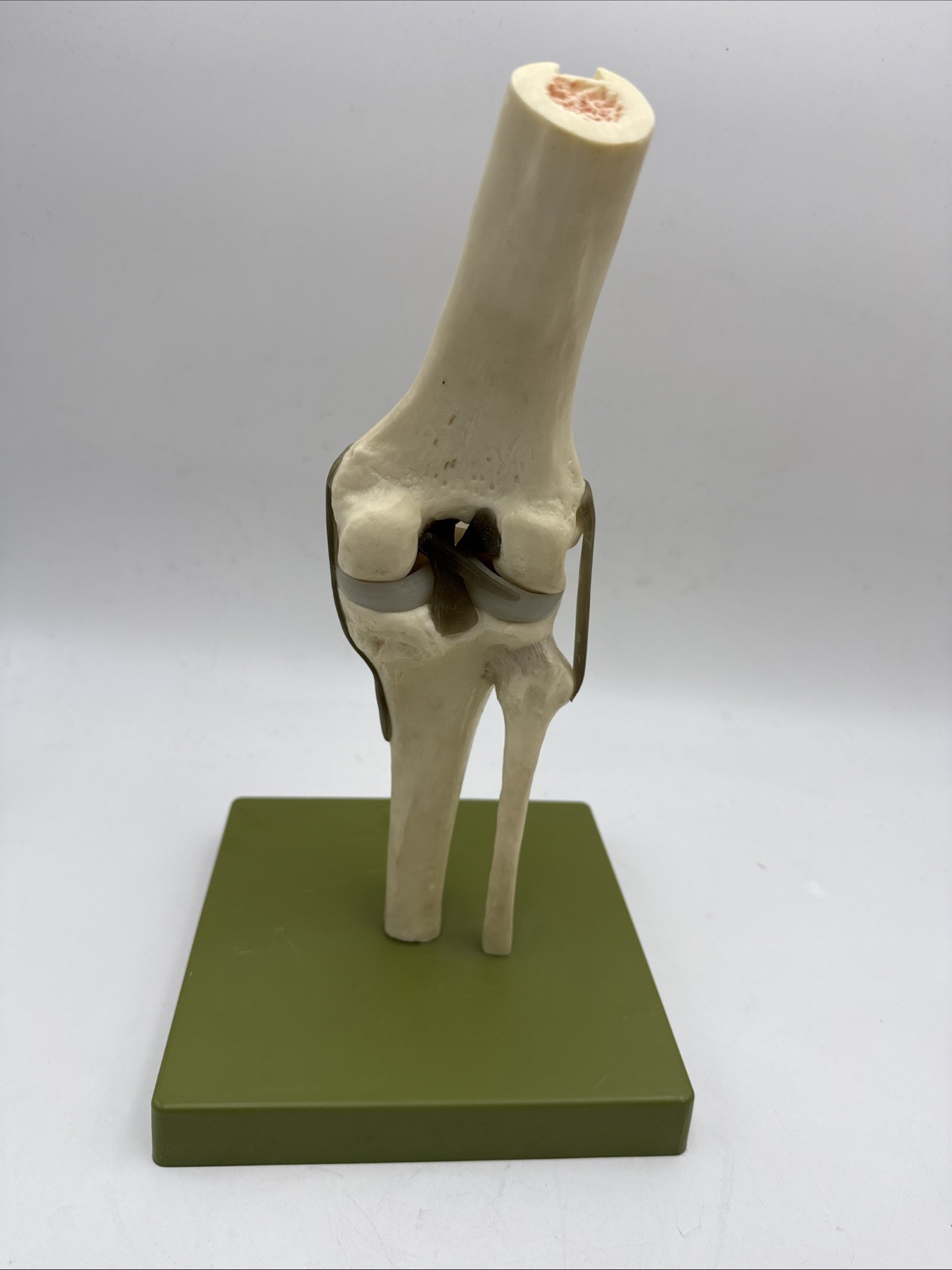 Somso NS50 Functional Knee Joint with Ligaments Anatomical Model NS 50