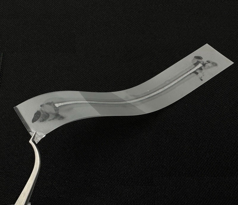Dental Material Flexible Fiber Strip Glass Splint Loose Tooth Fixation Strips US