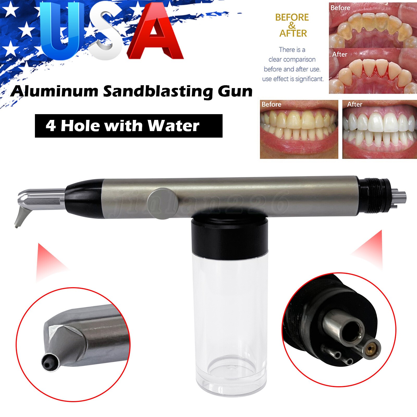Dental Aluminum Oxide Micro Blaster Air Polisher Abrasion Microetcher w/ Water
