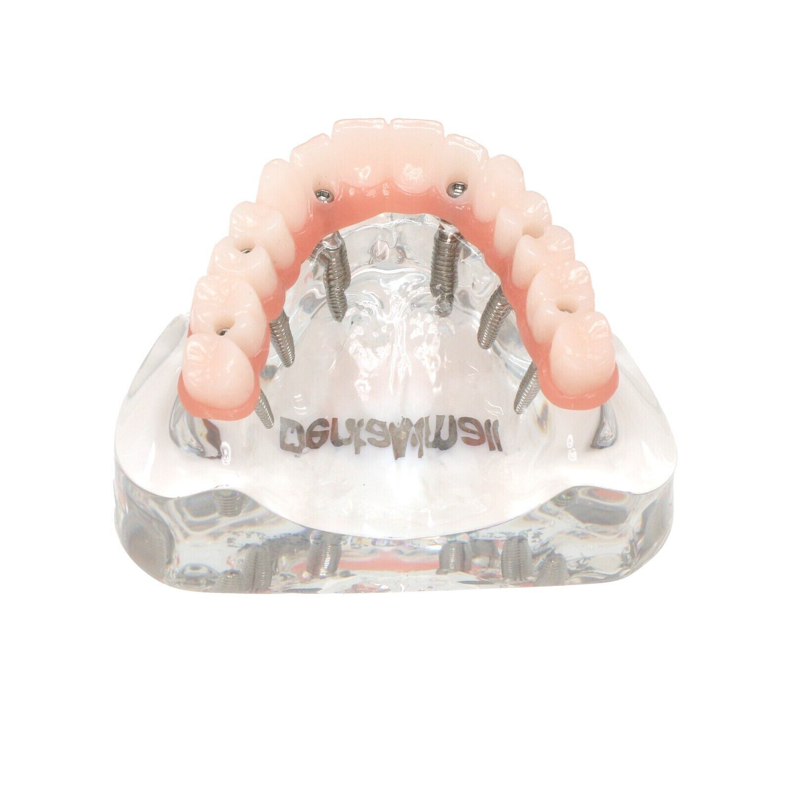 US Dental All-on-4/6 Screws Overdenture Implant Model Upper Jaw Restoration
