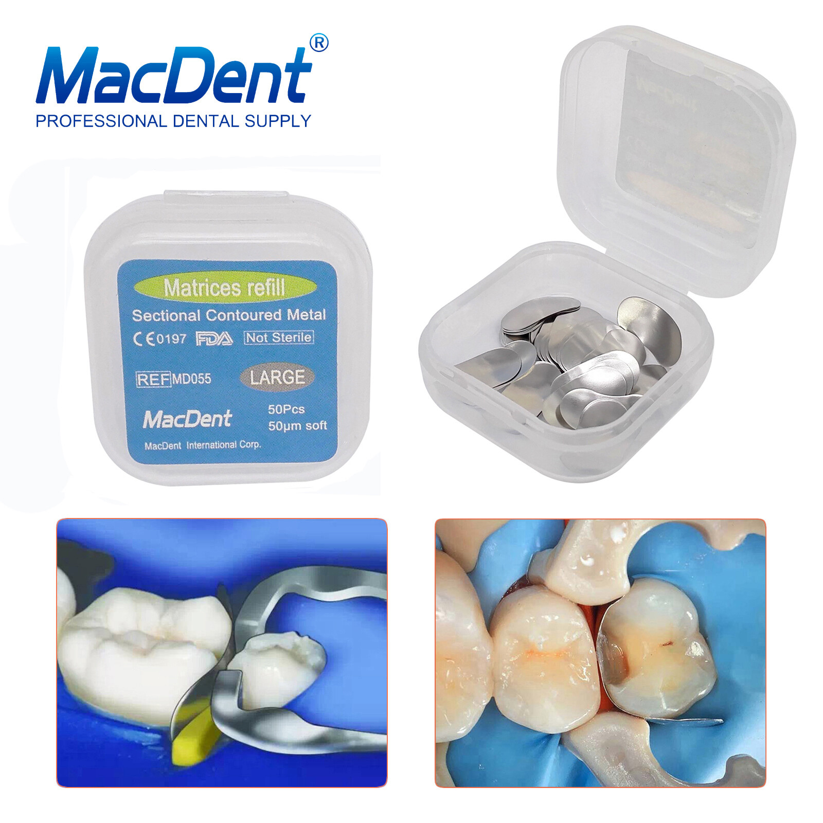 50Pcs/box MacDent Dental Sectional Contoured Matrices Matrix Bands Refill S/M/L
