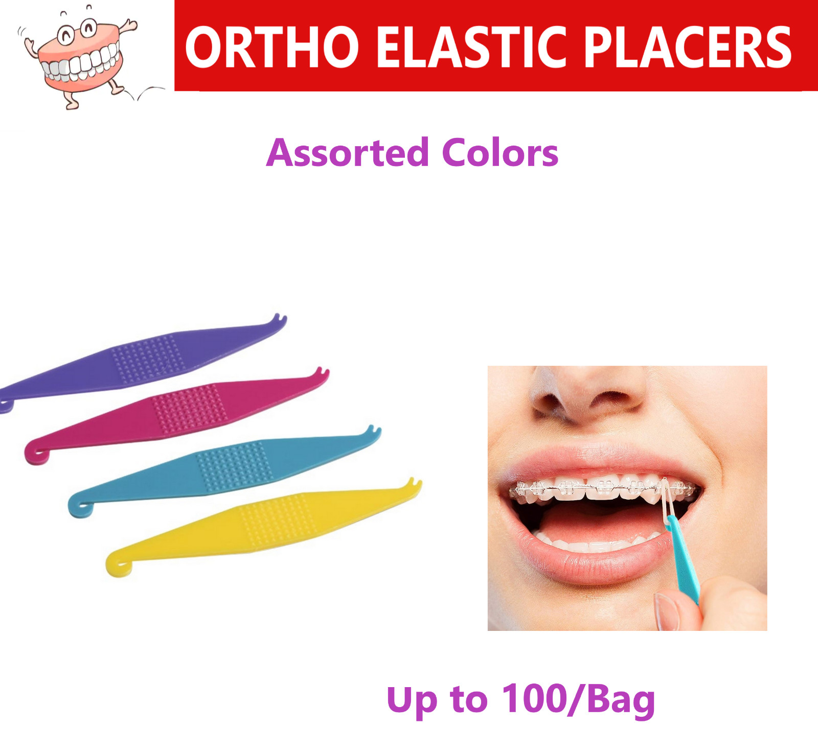 Dental ORTHO ELASTIC PLACERS – Purple, Yellow, Turquoise, Rose, 50/100/Bag