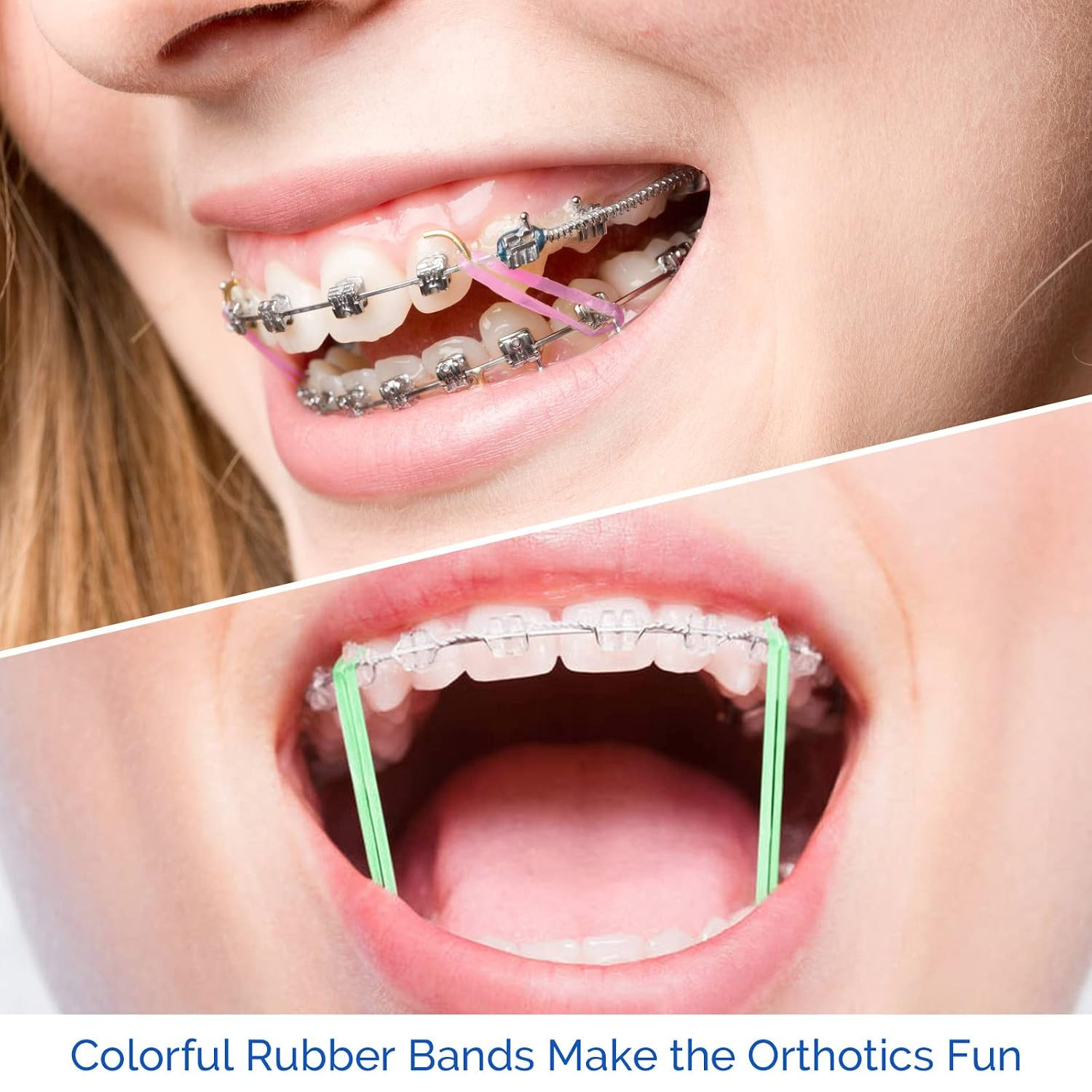 Orthodontic Elastics 3/16 Inch Heavy 6.5Oz 100 Pack Dental Rubber Bands