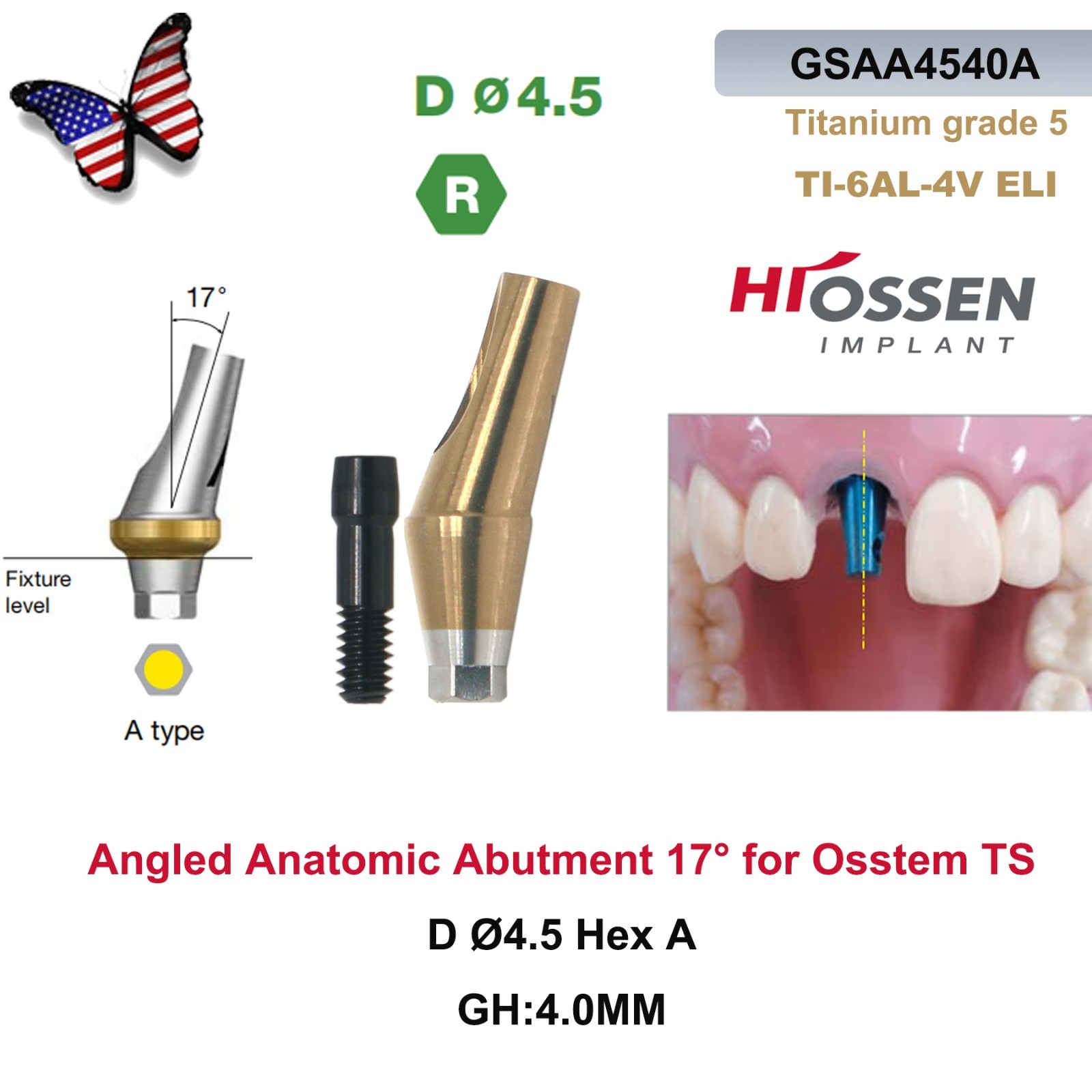 US 5Pcs 17° Angled Anatomic Abutment Hiossen Osstem Mini Regular Hex Titanium