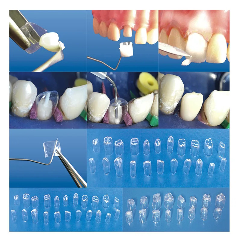 64Pcs Anterior Transparent Crowns Dental Pre-Crowned Temporary Adult Braces Kit