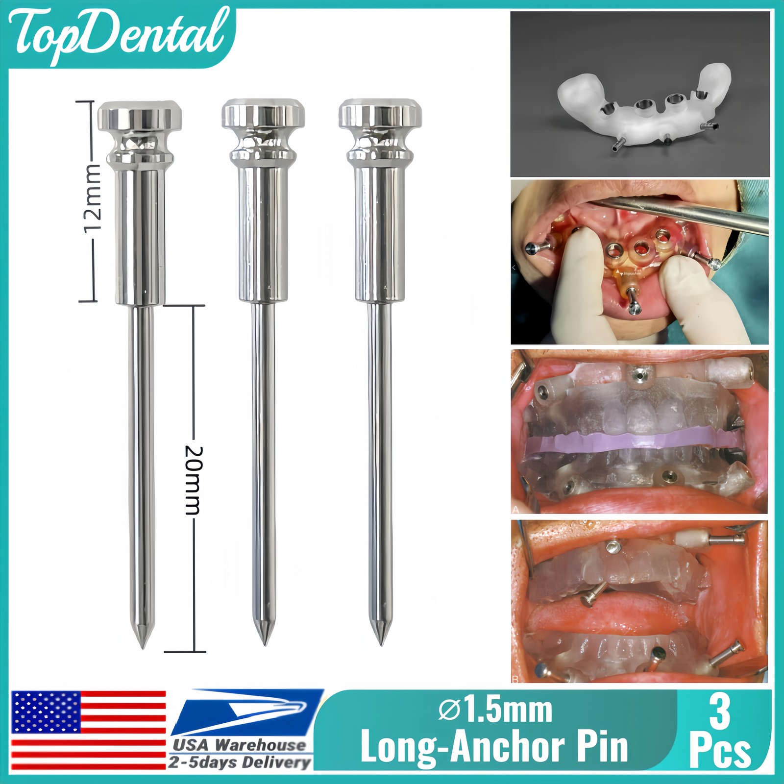 USA Dental 3DDX ⌀1.5 Long Guided Fixation Anchor Pin Denture Implant Plate DSG