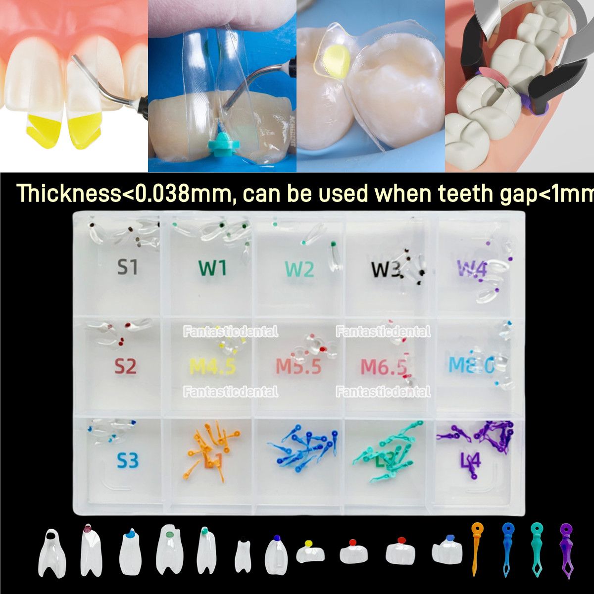 Clear Matrix Band Transparent Bow Matrices Dental Anterior Front Teeth Posterior