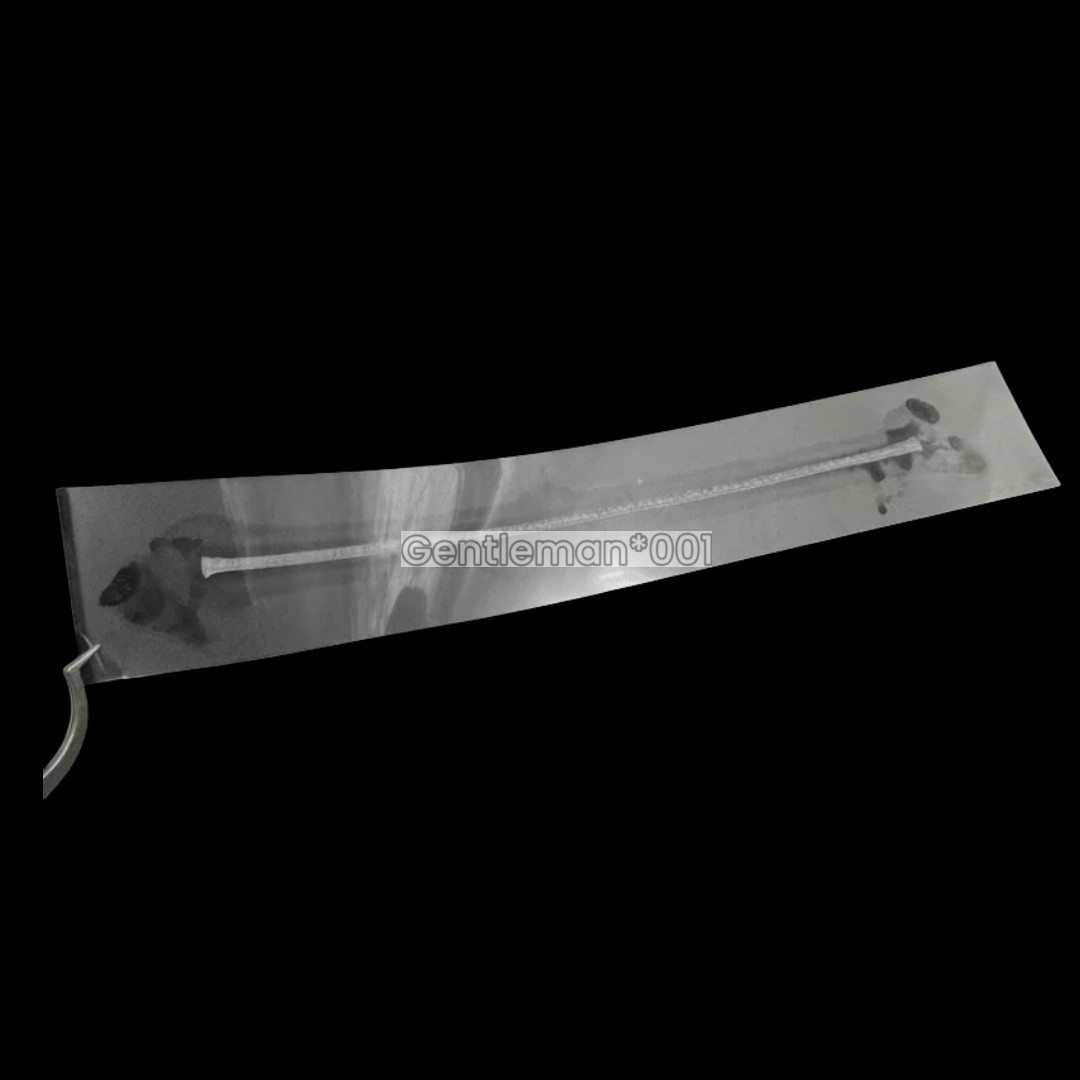 Dental Flexible Fiber Strip Band Retainer Glass Splint Loose Tooth Light Cure