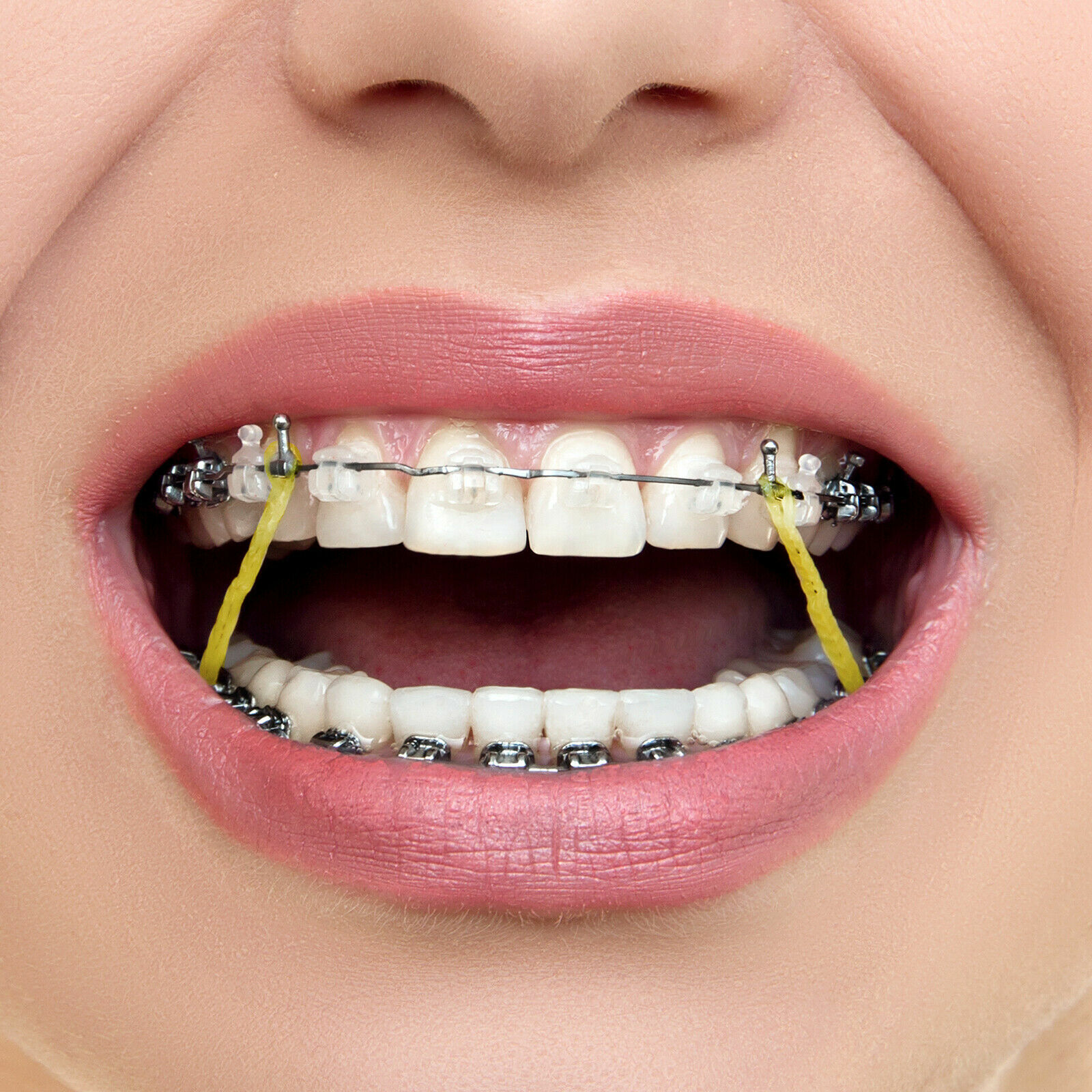 100Pcs/Bag JMU Dental Orthodontic Intra Oral Elastic Latex Rubber Bands 13 Sizes