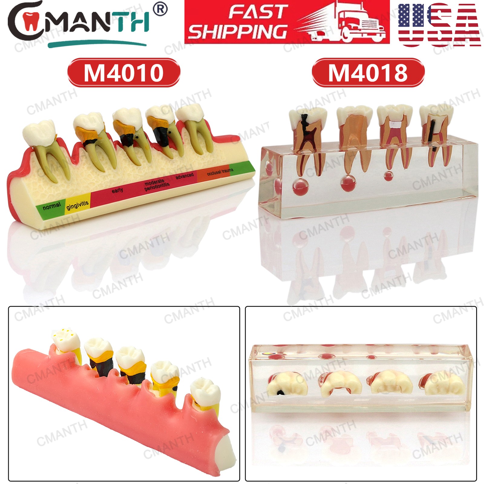 US Dental Teeth Model Implant Periodontal Disease Suture Drilling Training Demo