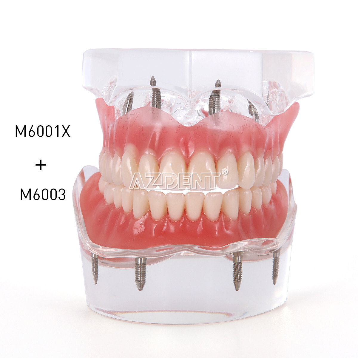 Dental Overdenture Implant Teeth Model Denture with implant Demonstration Clear