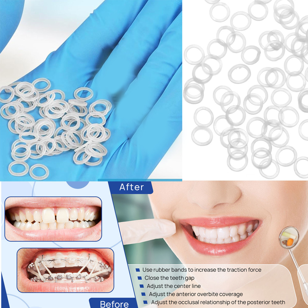 US 1,000pcs Dental Ortho NON-LATEX Rubber Bands O-ring 3/16 4.5oz latex free