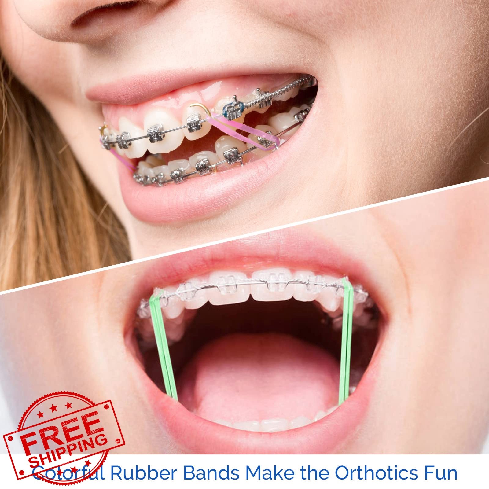 JMU 3/8 Medium Neon Orthodontic Rubber Bands