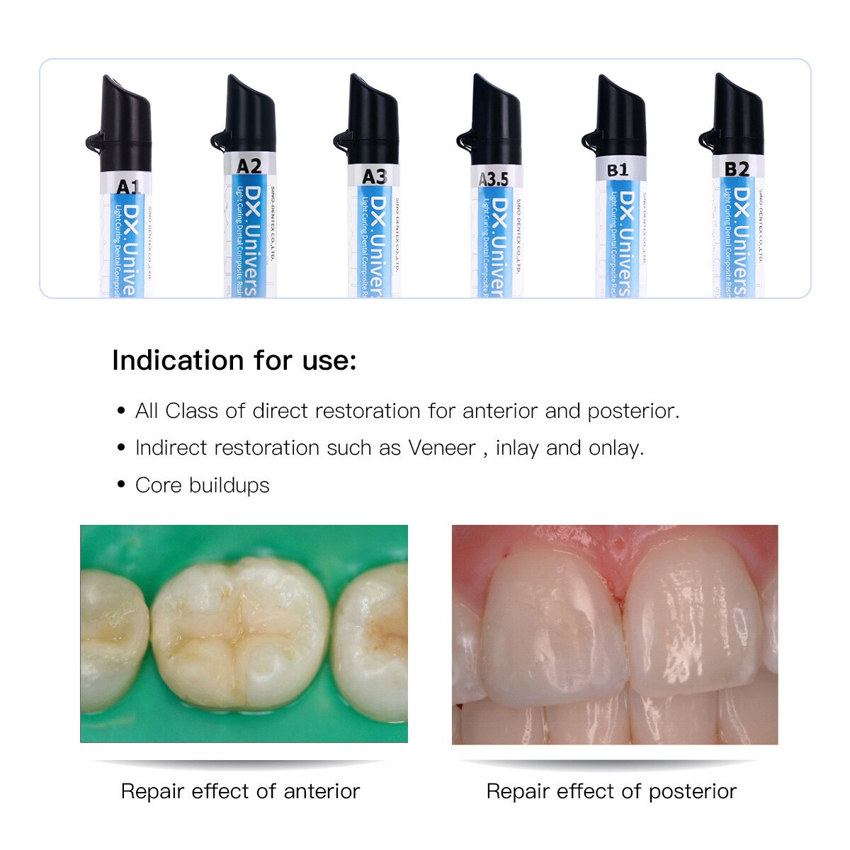 Dentex Dental Universal Composite Resin Light Cure A1/A2/A3/A3.5/B1