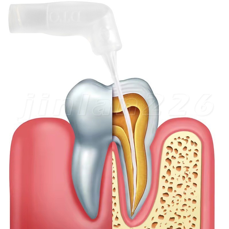 20-400Pcs Dental Endo Root Canal Tip Irrigator Irrigation Needle Tips Flushing